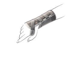 Tenortho PF Tutore Polso EL C/ST DX M